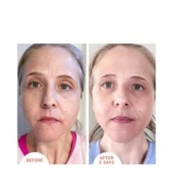 Dr Dennis Gross Alpha Beta Peel Extra Strength -Body Care Store Alpha Beta Peel Extra Strength add2 26579 3958 general